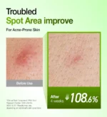 Anua Azelaic Acid 10 Hyaluron Redness Soothing Serum 30 mL - Image 3